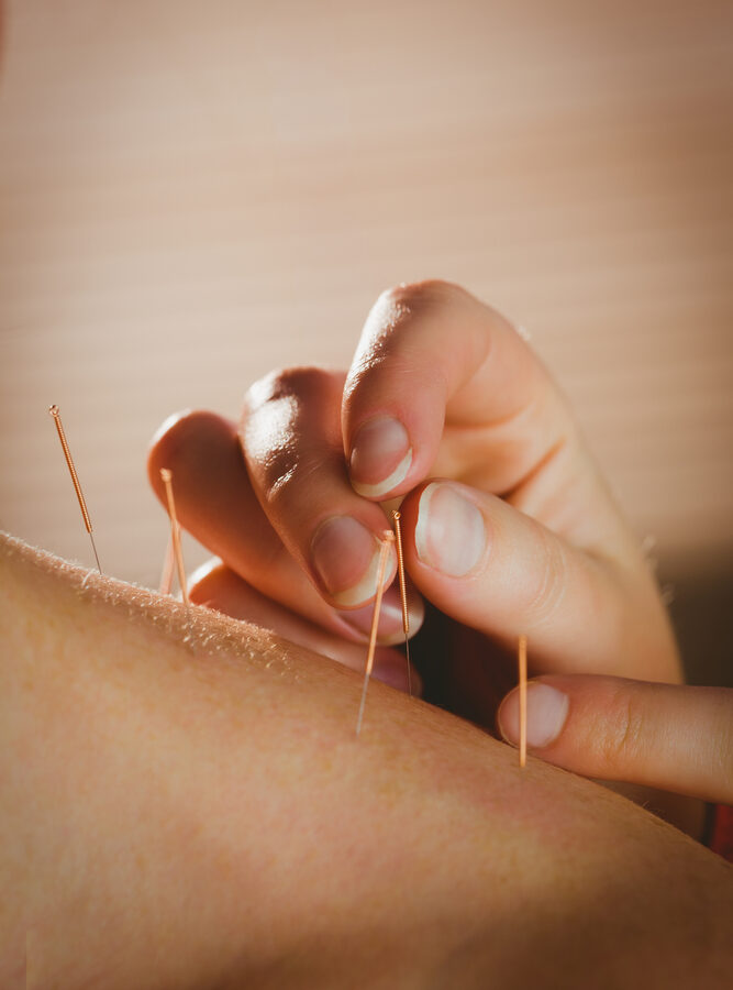 Vorteiler einer Akupunktur in Bötzingen