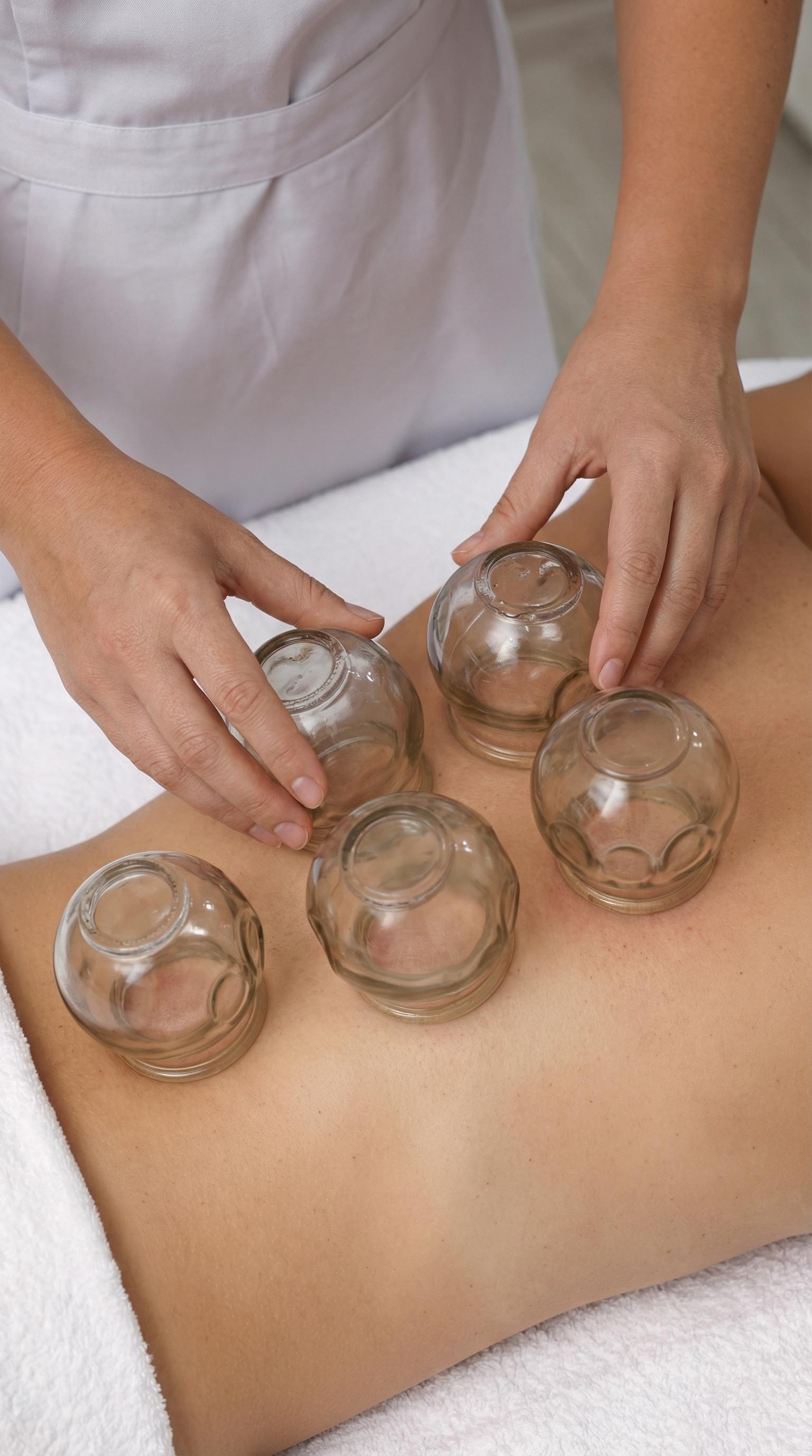 Zwei Hände eines Therapeuten platzieren fünf durchsichtige Schröpfgläser auf dem oberen Rücken einer Person, die auf einem weißen Handtuch liegt. Die Haut unter den Gläsern ist leicht gerötet.